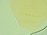 Pseudechiniscus novaezeelandiae image