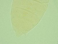 Pseudechiniscus novaezeelandiae image