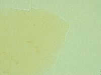 Pseudechiniscus novaezeelandiae image