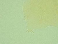 Pseudechiniscus novaezeelandiae image