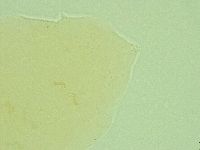 Pseudechiniscus novaezeelandiae image