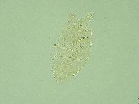Pseudechiniscus novaezeelandiae image