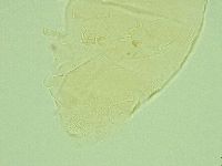 Pseudechiniscus novaezeelandiae image