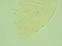 Pseudechiniscus novaezeelandiae image