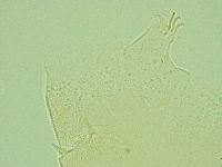Pseudechiniscus novaezeelandiae image