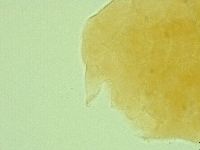 Pseudechiniscus novaezeelandiae image