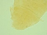 Pseudechiniscus novaezeelandiae image