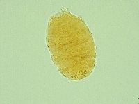 Pseudechiniscus novaezeelandiae image