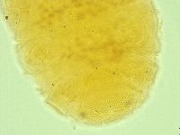 Pseudechiniscus novaezeelandiae image
