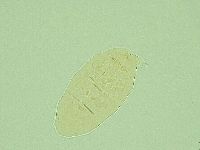 Pseudechiniscus novaezeelandiae image