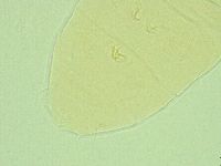 Pseudechiniscus novaezeelandiae image