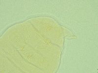 Pseudechiniscus novaezeelandiae image