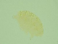 Pseudechiniscus novaezeelandiae image