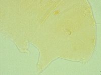 Pseudechiniscus novaezeelandiae image