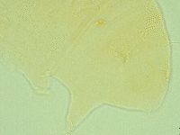 Pseudechiniscus novaezeelandiae image