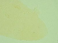 Pseudechiniscus suillus image