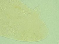 Pseudechiniscus suillus image