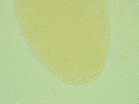 Pseudechiniscus suillus image