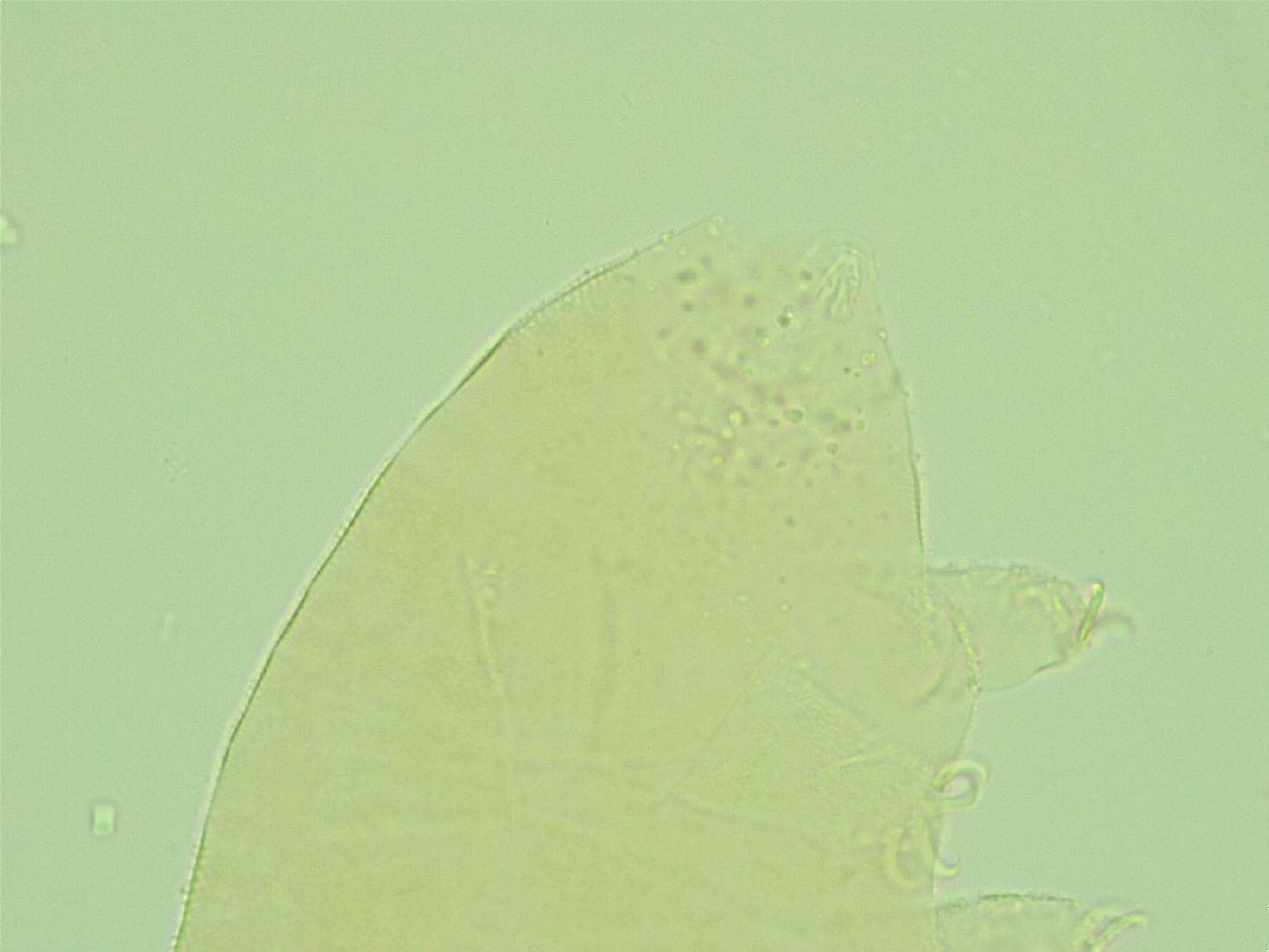 Pseudechiniscus ramazzottii image