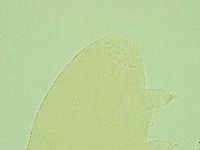 Pseudechiniscus ramazzottii facettalis image