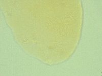 Pseudechiniscus ramazzottii facettalis image