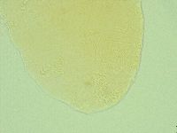 Pseudechiniscus ramazzottii image