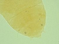 Pseudechiniscus ramazzottii image