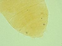 Pseudechiniscus ramazzottii image
