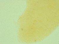 Pseudechiniscus ramazzottii facettalis image