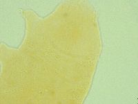 Pseudechiniscus ramazzottii image