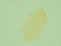 Pseudechiniscus ramazzottii facettalis image