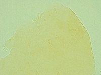 Pseudechiniscus ramazzottii image