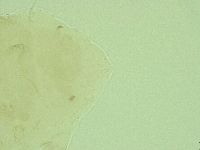 Pseudechiniscus ramazzottii image