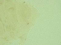 Pseudechiniscus ramazzottii image