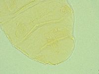 Pseudechiniscus ramazzottii facettalis image