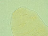 Pseudechiniscus ramazzottii image