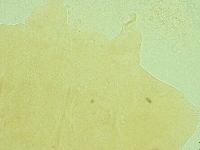 Pseudechiniscus ramazzottii facettalis image