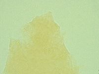 Pseudechiniscus ramazzottii image