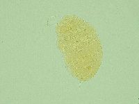 Pseudechiniscus ramazzottii facettalis image