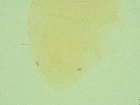 Pseudechiniscus ramazzottii image