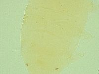 Pseudechiniscus ramazzottii image