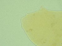 Pseudechiniscus ramazzottii facettalis image
