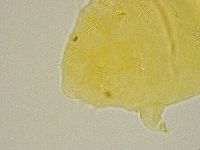 Pseudechiniscus ramazzottii image