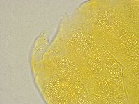 Pseudechiniscus ramazzottii image