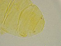 Pseudechiniscus ramazzottii image