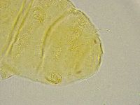 Pseudechiniscus ramazzottii image