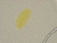 Pseudechiniscus ramazzottii facettalis image