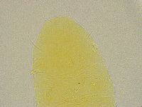 Pseudechiniscus ramazzottii facettalis image