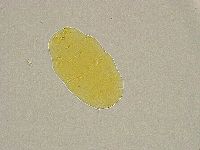 Pseudechiniscus ramazzottii image