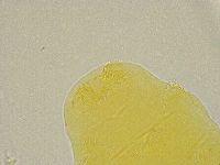 Pseudechiniscus ramazzottii image